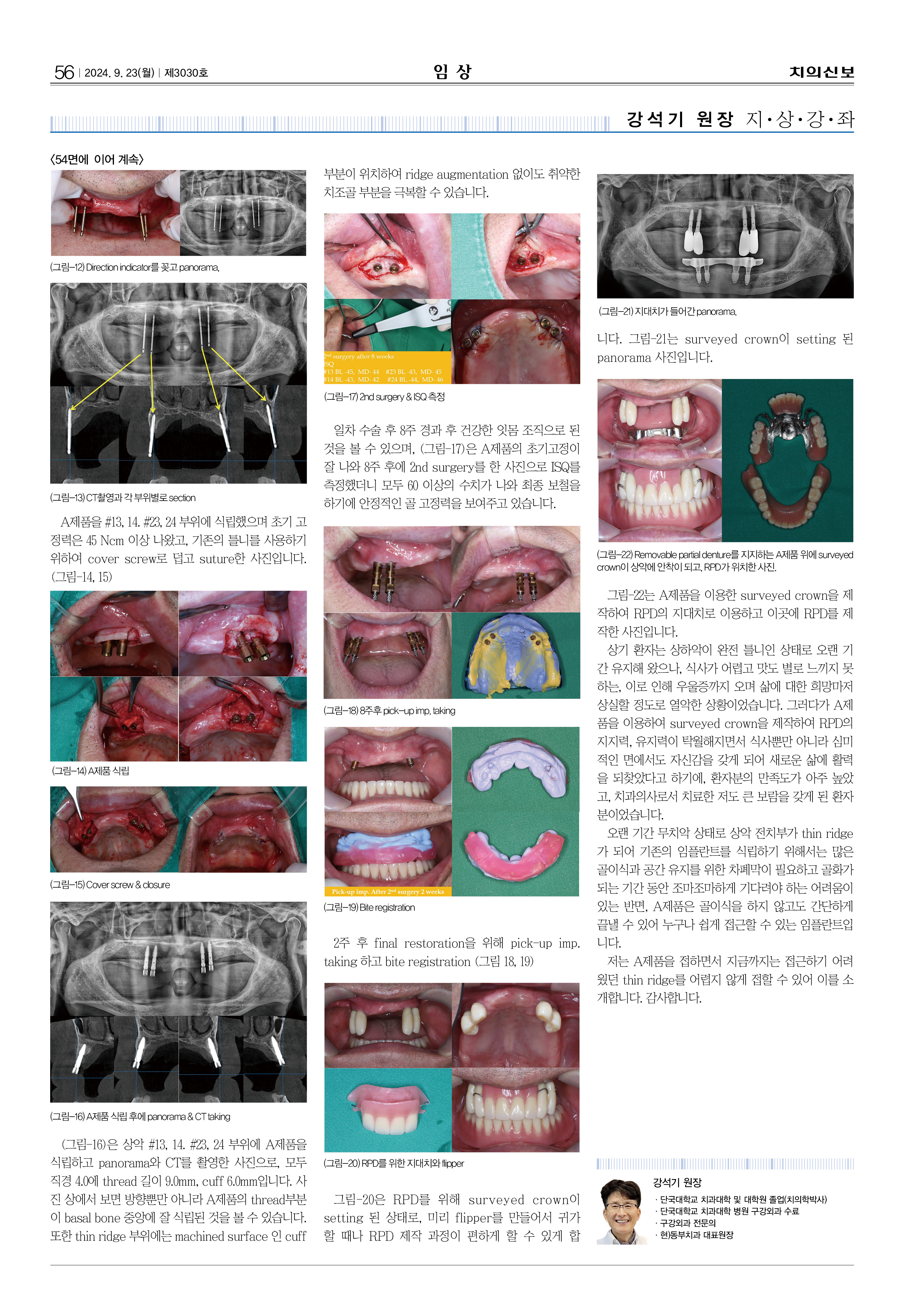 임상2