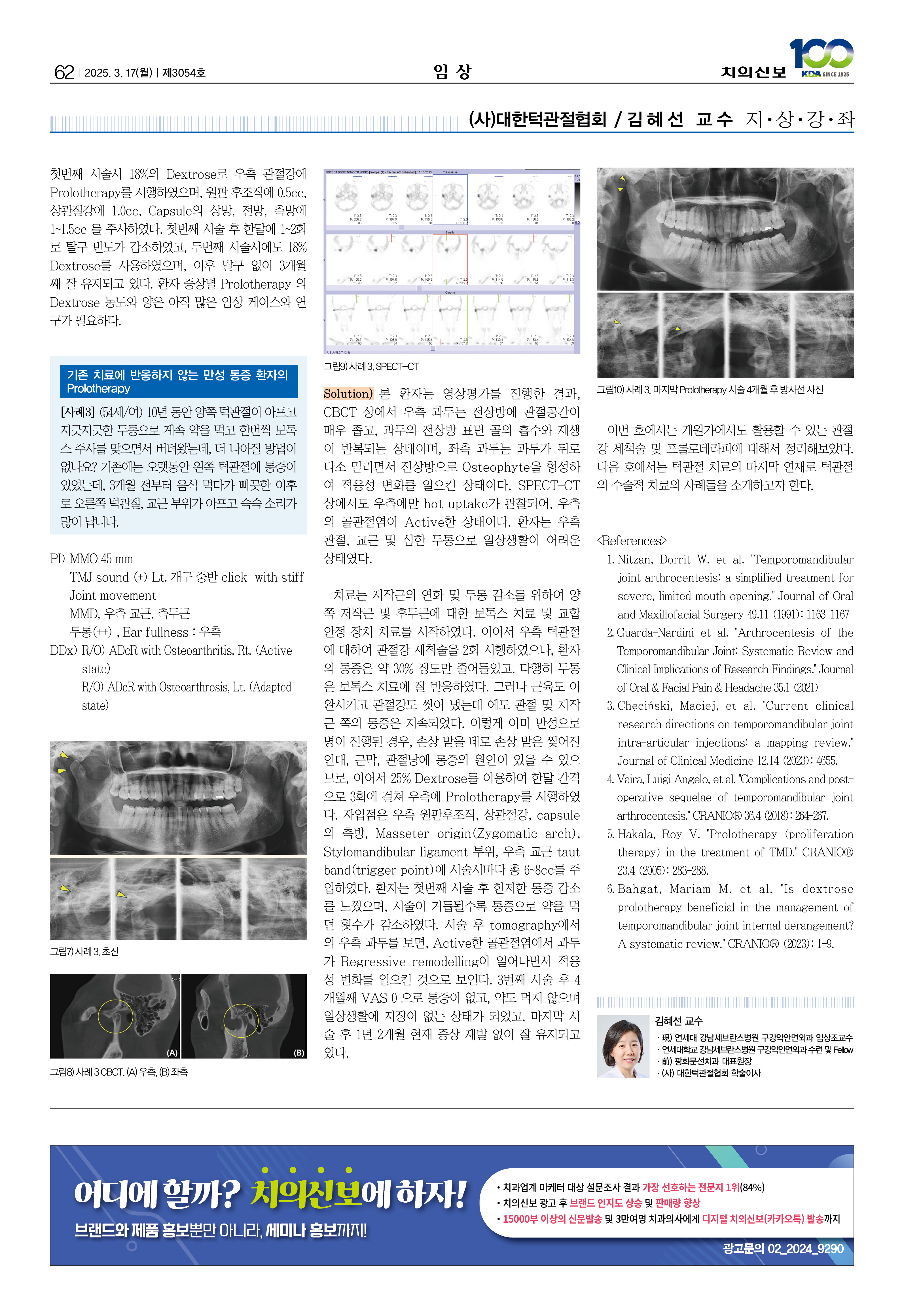 63_0312_임상