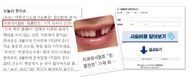 치협 사칭 임플란트 할인 광고까지 ‘선 넘은’ 마케팅