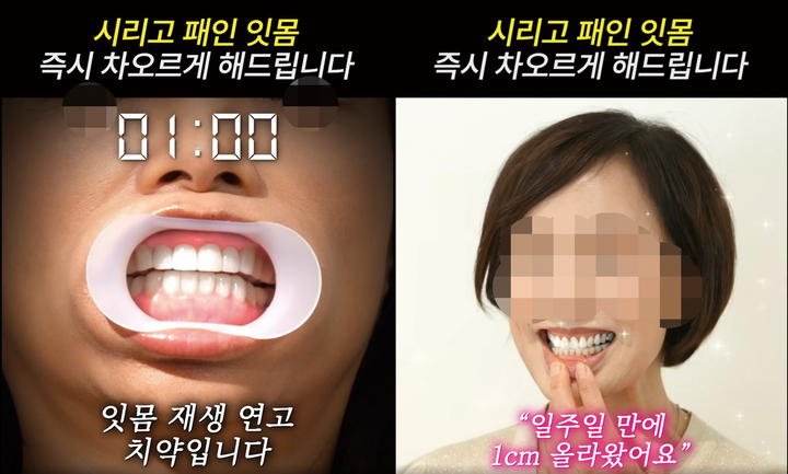 “양치만으로 잇몸 차올라” 소비자 기망 치약 광고